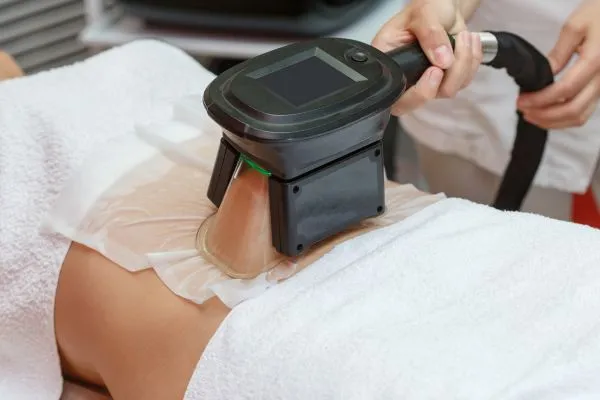 Image of person having fat freezing treatment to help weight gain Winkfield