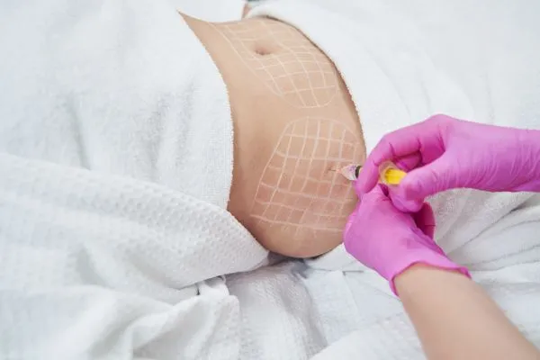 image of fat dissolving injections on love handles to help combat weight gain Winkfield
