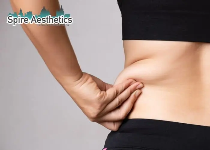 Image of woman pinching fat on their hips Winkfield. Fat Freezing treatment