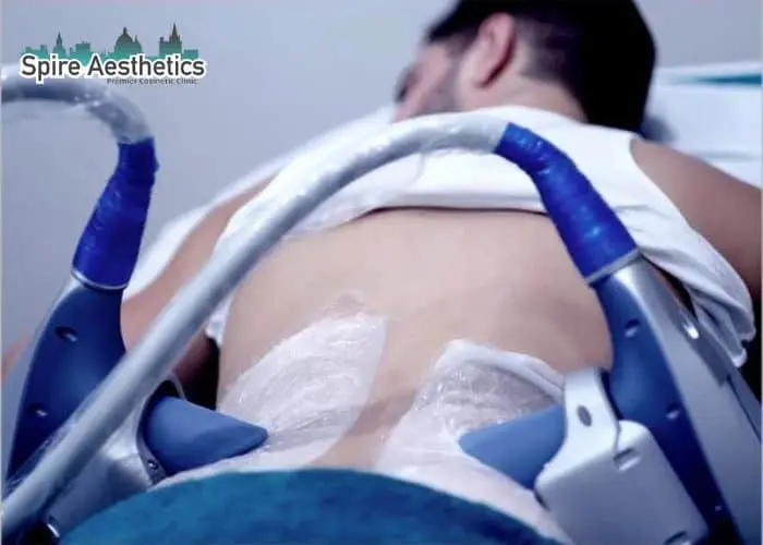 Man having fat freezing treatment done on love handles before a competitions Winkfield to create a sculpted look.