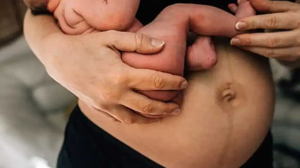 Why Is My Stomach Still Big After Pregnancy Winkfield?