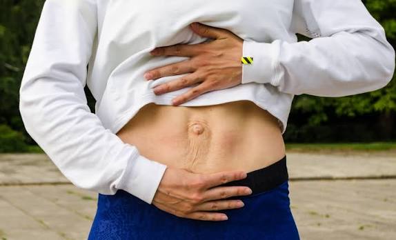 When Could Diastasis Recti Be the Missing Piece of the Puzzle Winkfield?